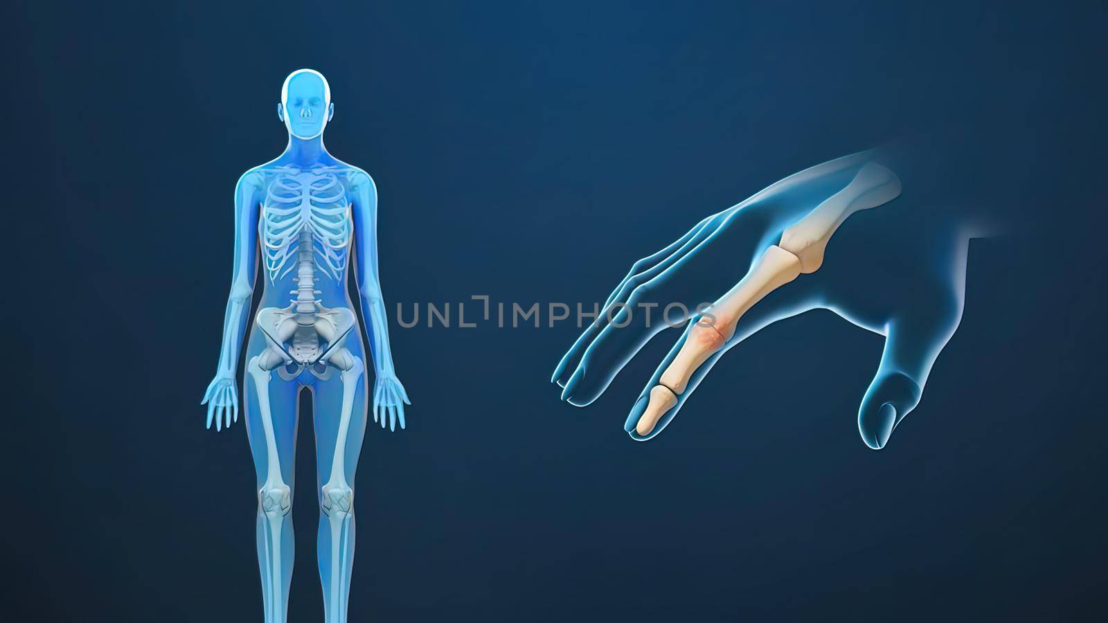 joint pain, rheumatoid arthritis and osteoarthritis by creativepic