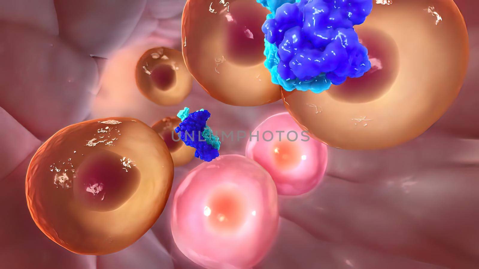 Metastasis for cancer that spreads to a different part of the body from where it 3D illustration