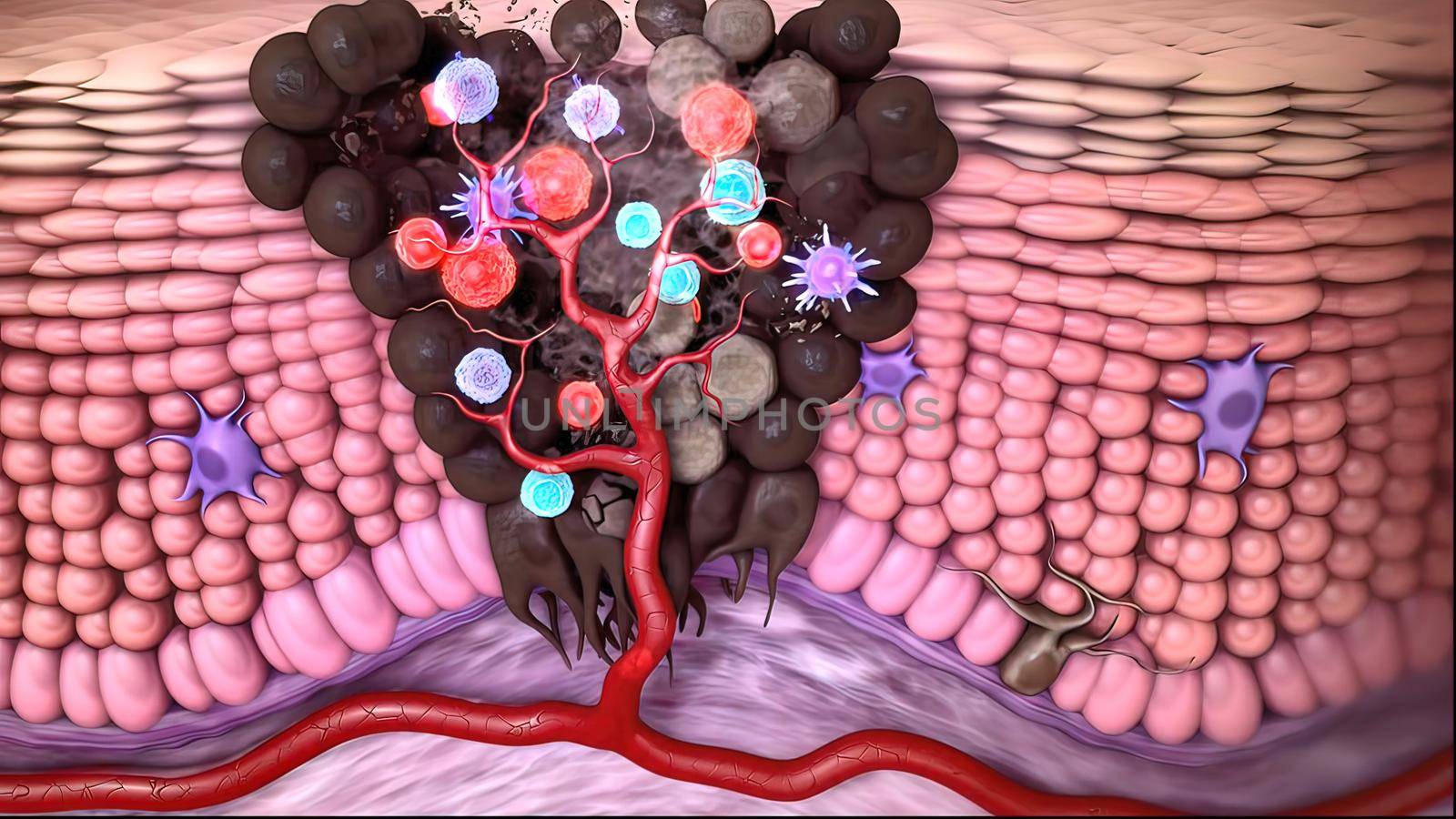 Antibodies destroy an infected cell by a virus, immun defense kill the infected cell 3D illustration
