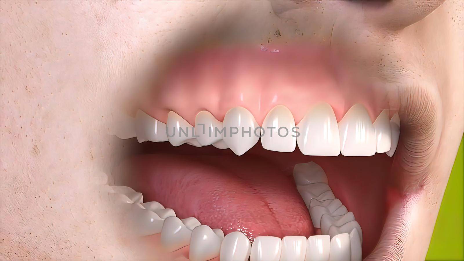 Dental implant surgery. by creativepic