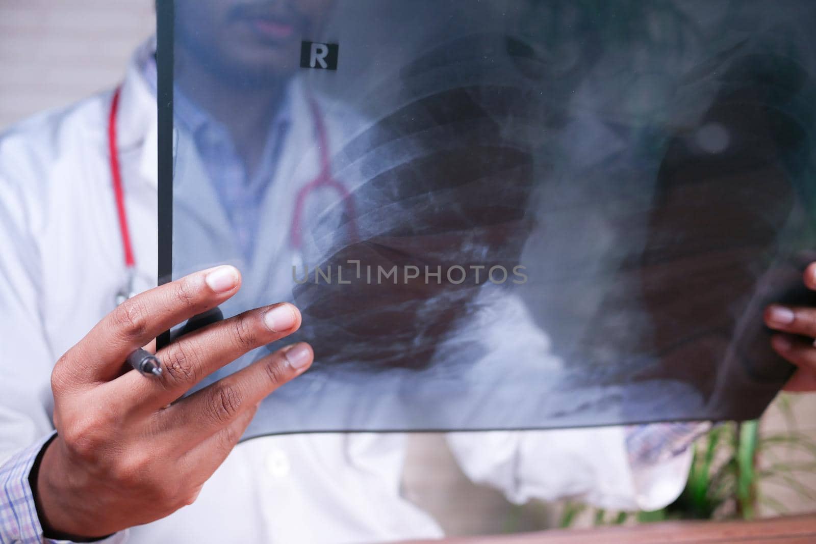 doctor hold analyzing xray photography closeup