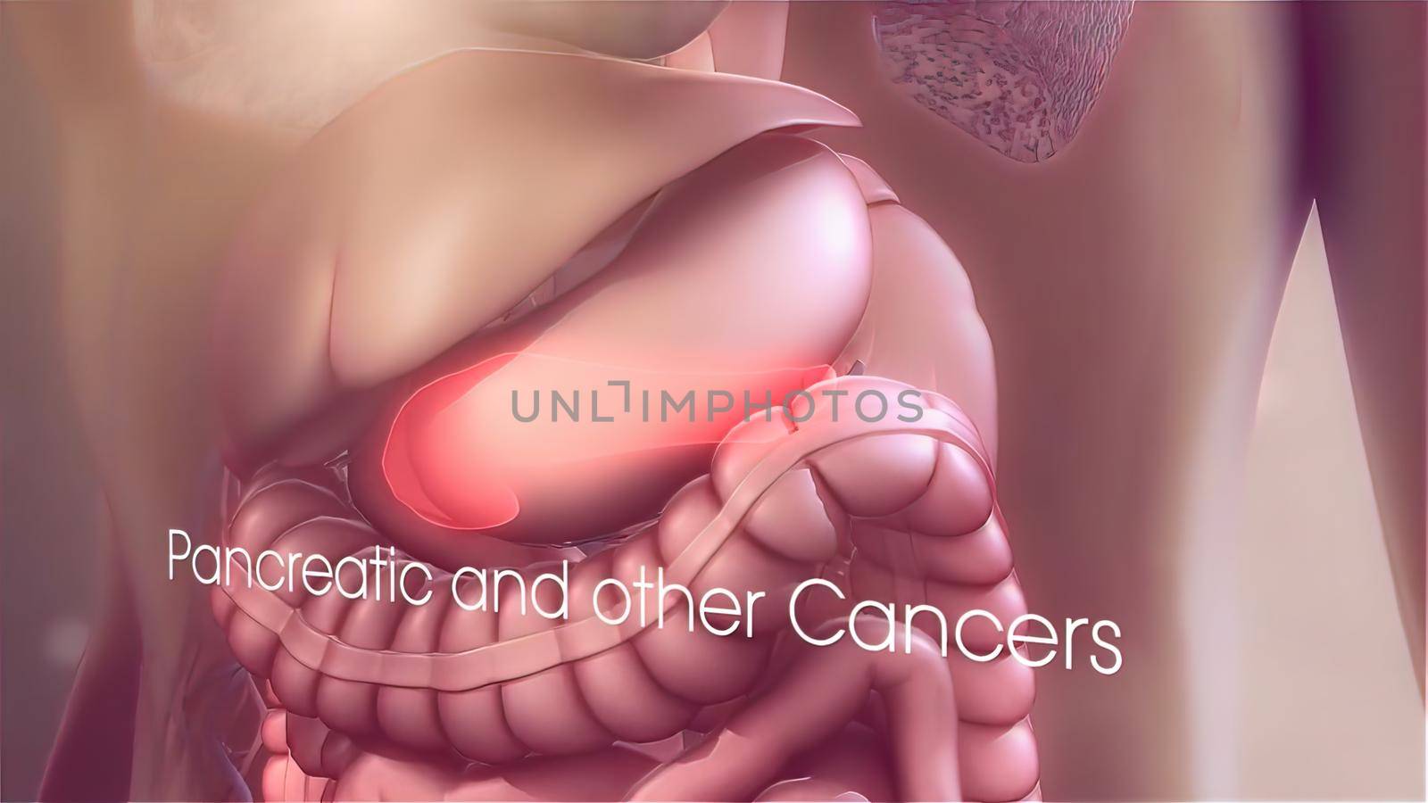 internal organ diseases 3D illustration