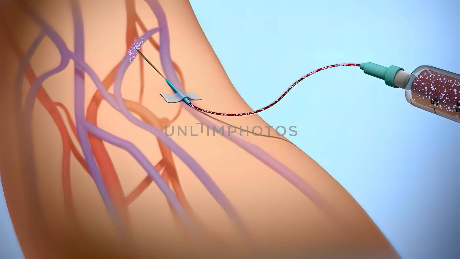 Serum At The Emergency Medicine 3D illustration