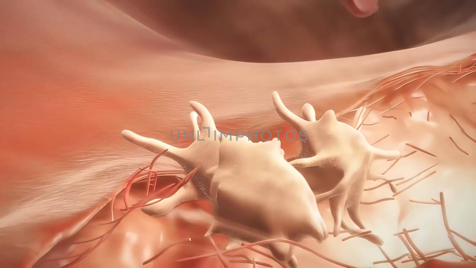 Hemophilia is usually an inherited bleeding disorder in which the blood does not clot properly 3D illustration