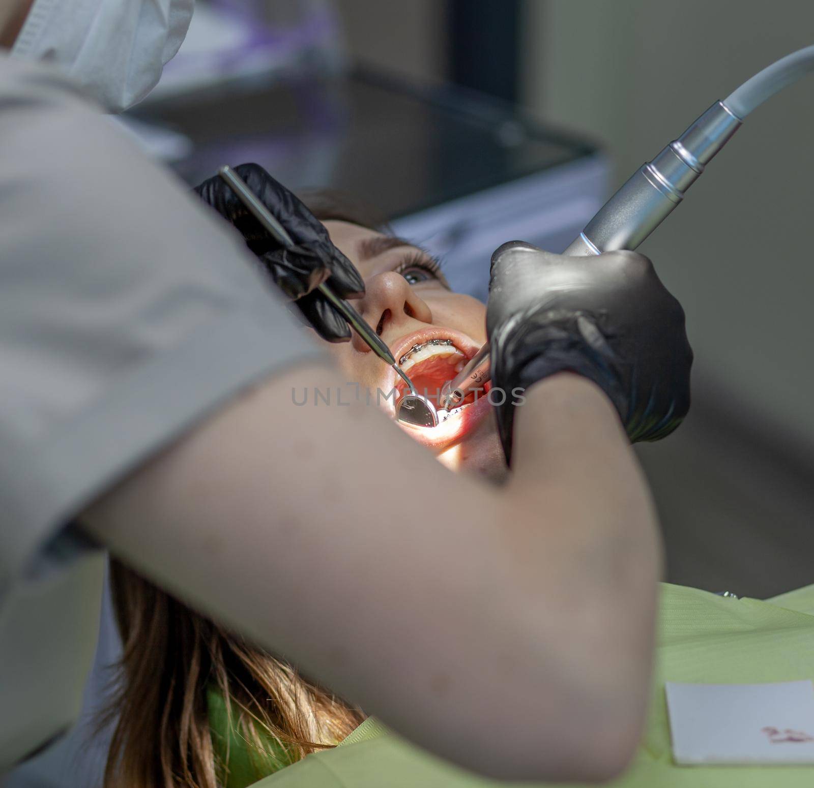 A woman at a dentist's appointment to replace arches with braces by AnatoliiFoto