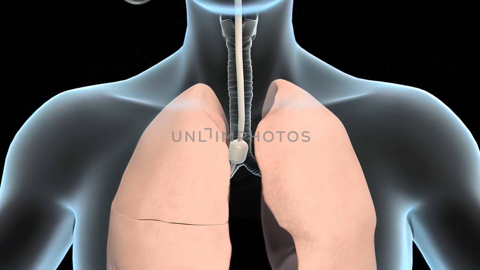 Intubation is the process of advancing a thin tube, called an endotracheal tube, from the mouth to the respiratory tract. 3D illustration