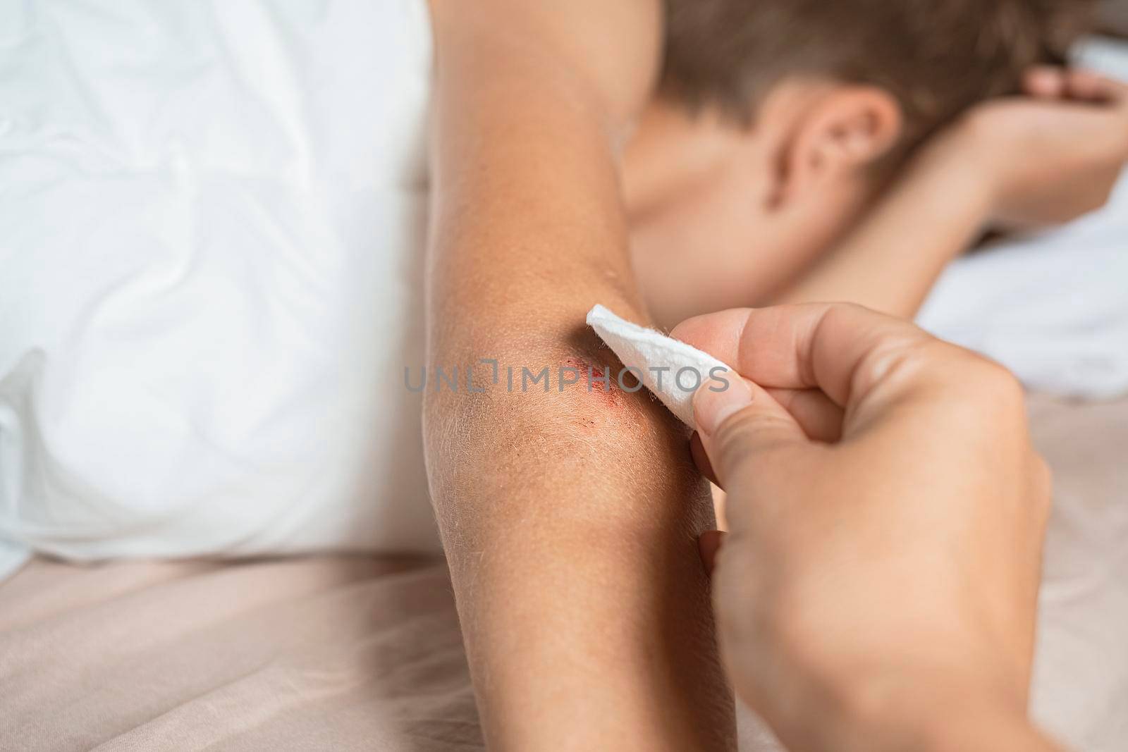 Woman hand using white cotton pad and cleaning abrasion on baby hand skin after accident. Mother giving first aid. Closeup.