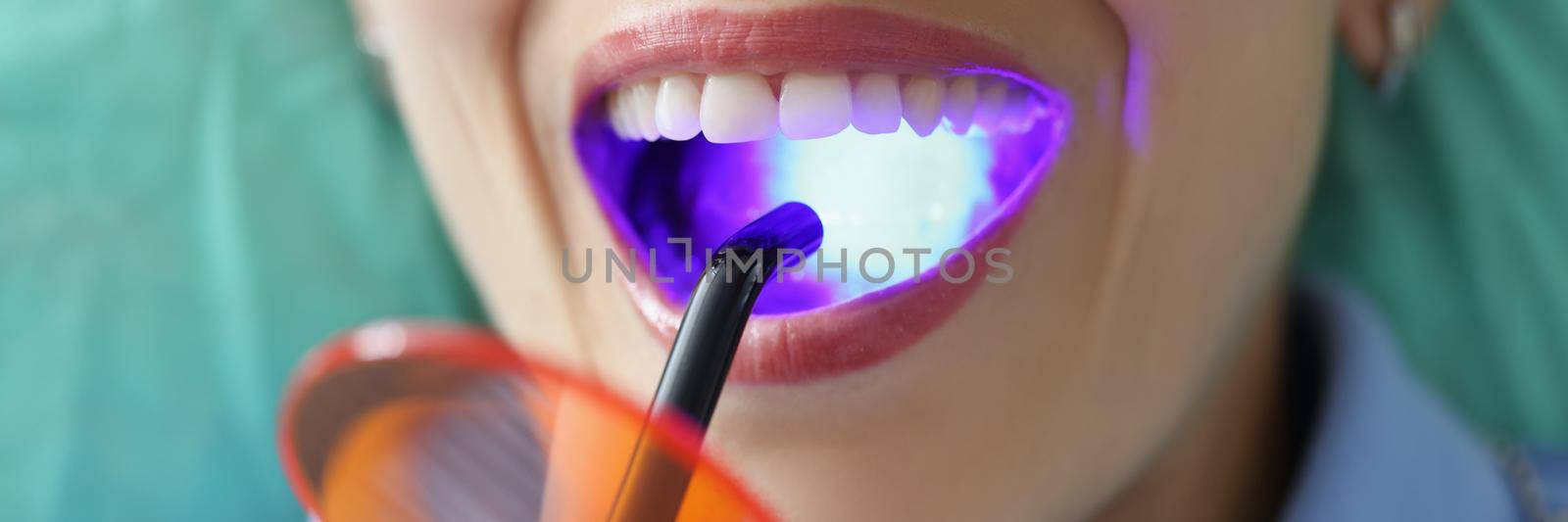 Close-up of woman with open mouth on dentist appointment try whitening procedure. Special tool with neon light. Dentistry, stomatology, teethcare concept