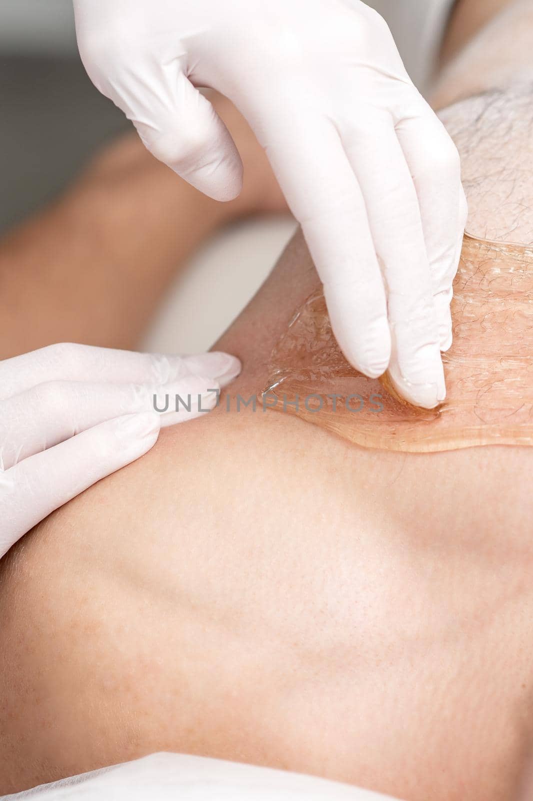 Epilation chest of young male with liquid wax paste by hands of female cosmetologist in beauty salon