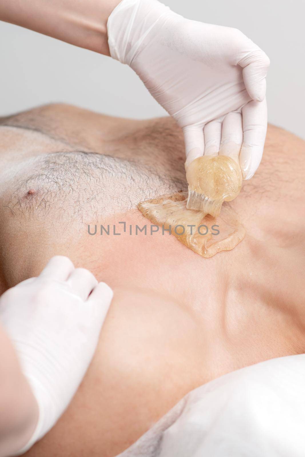 Epilation chest of young male with liquid wax paste by hands of female cosmetologist in beauty salon