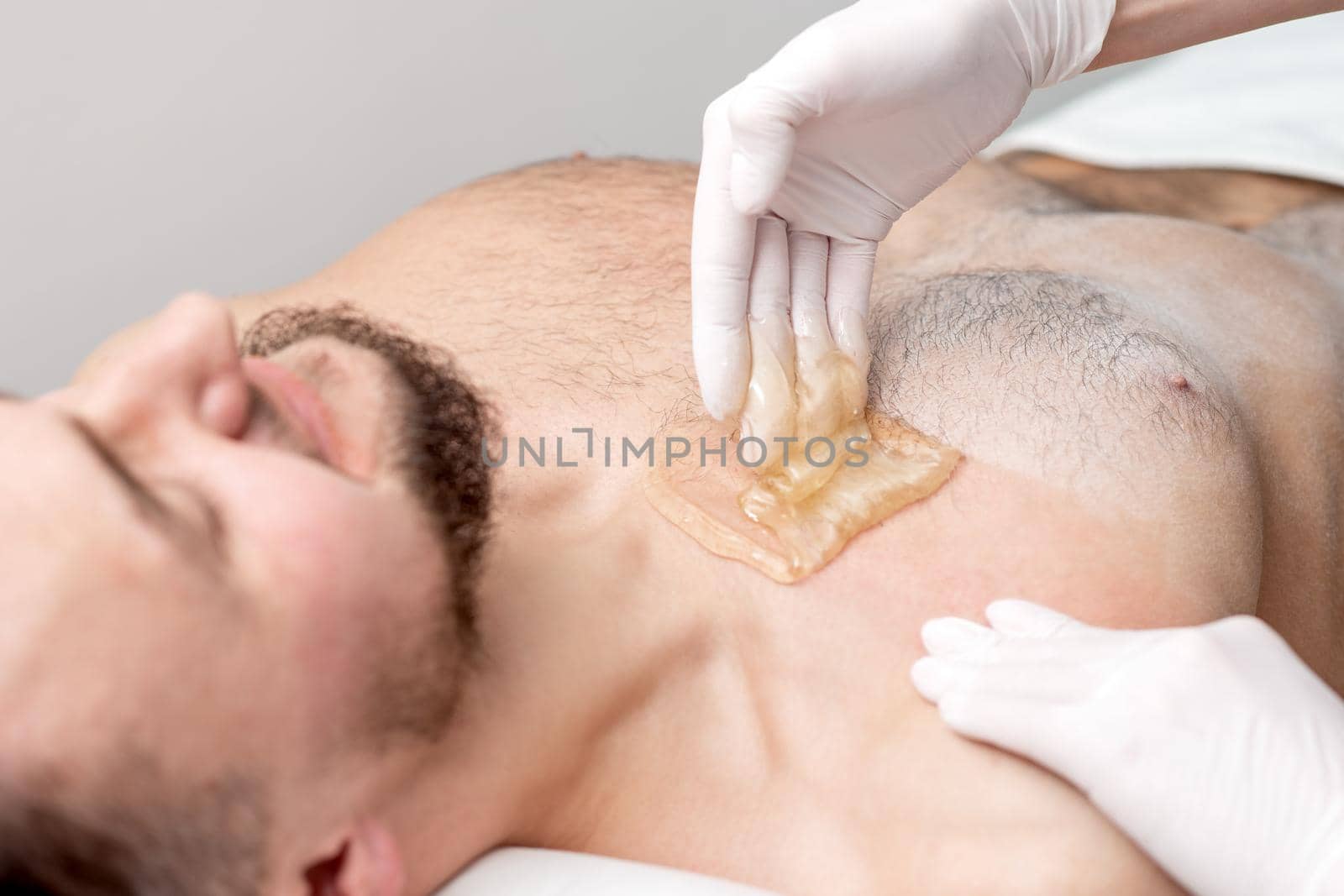 Epilation chest of young male with liquid wax paste by hands of female cosmetologist in beauty salon