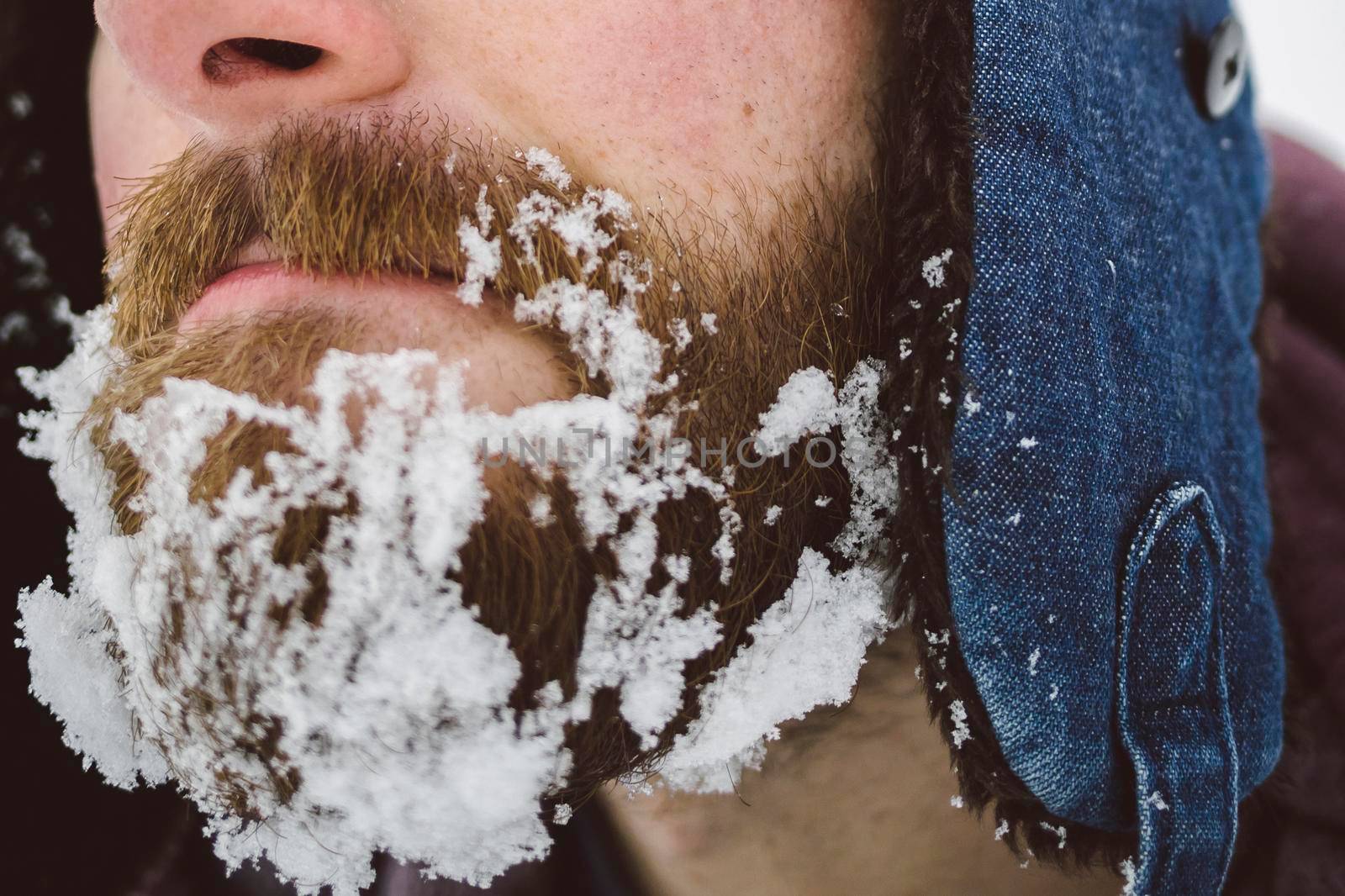 Frozen snow on the beard.