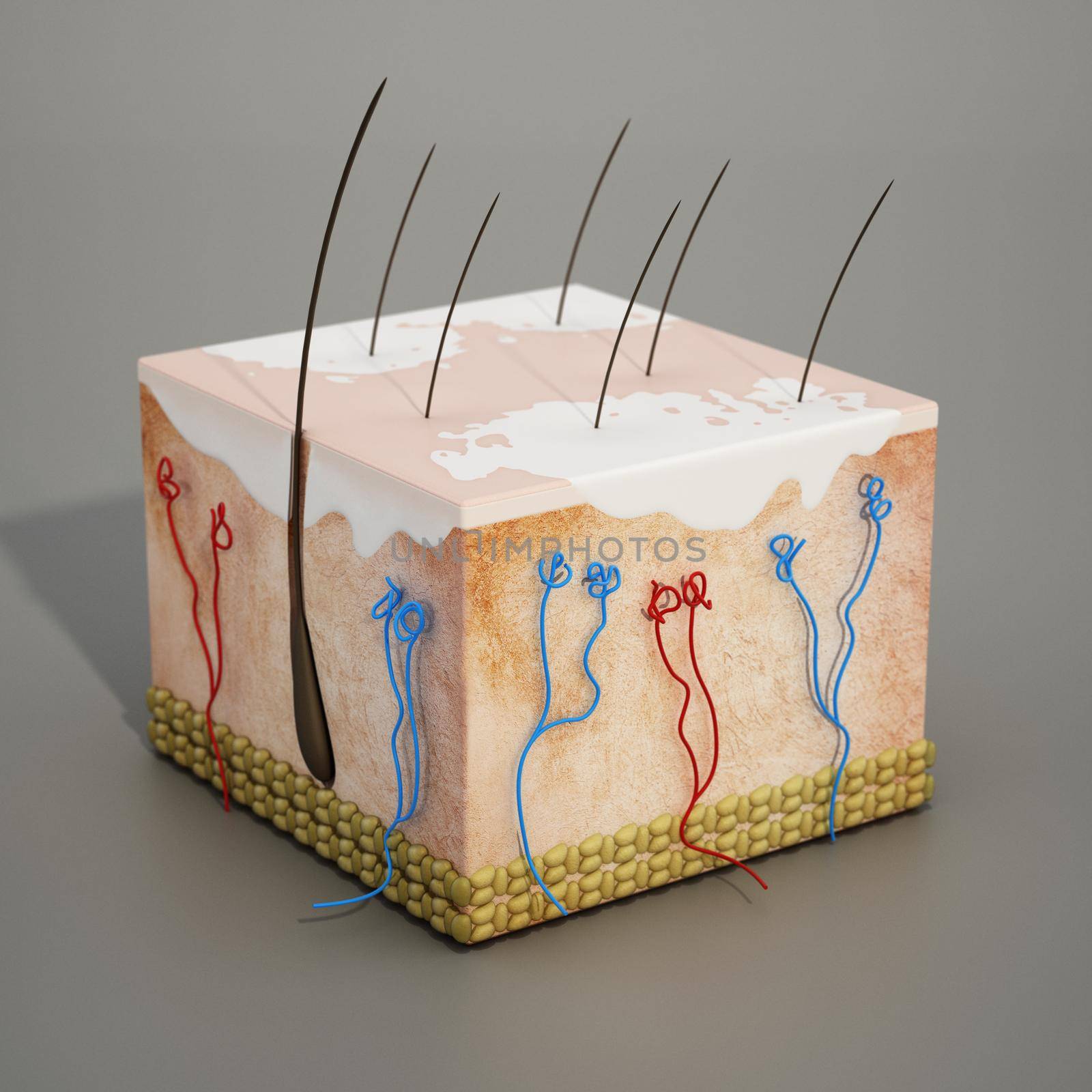 3D structure of a human skin section with vitiligo disease. 3D illustration.