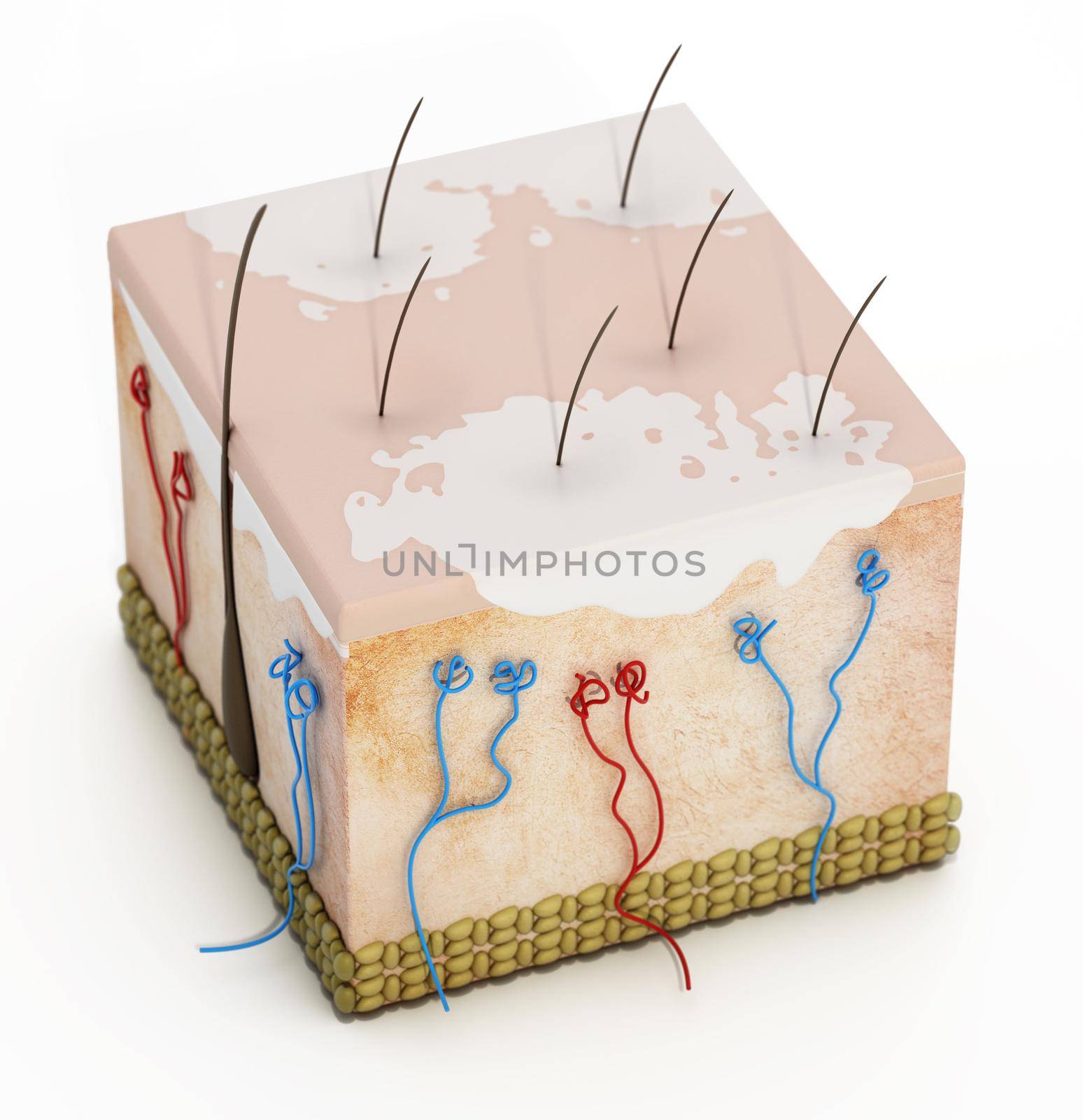 3D structure of a human skin section with vitiligo disease. 3D illustration.