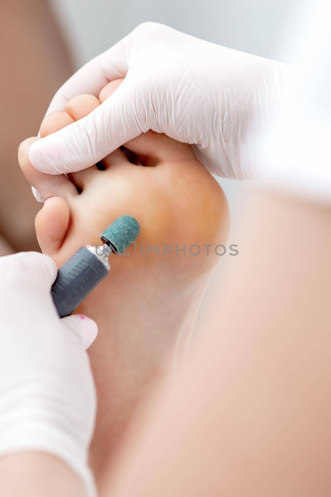 Peeling feet pedicure procedure from callus on foot by hands of podiatrist in white gloves at beauty salon
