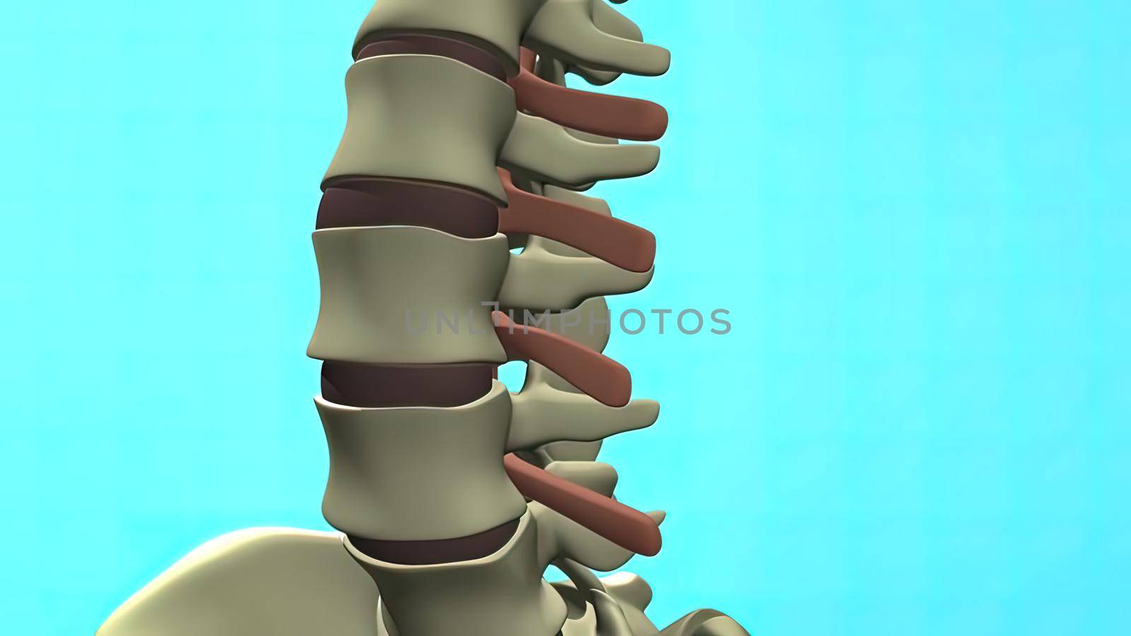 nerve compression of discs 3d medical by creativepic