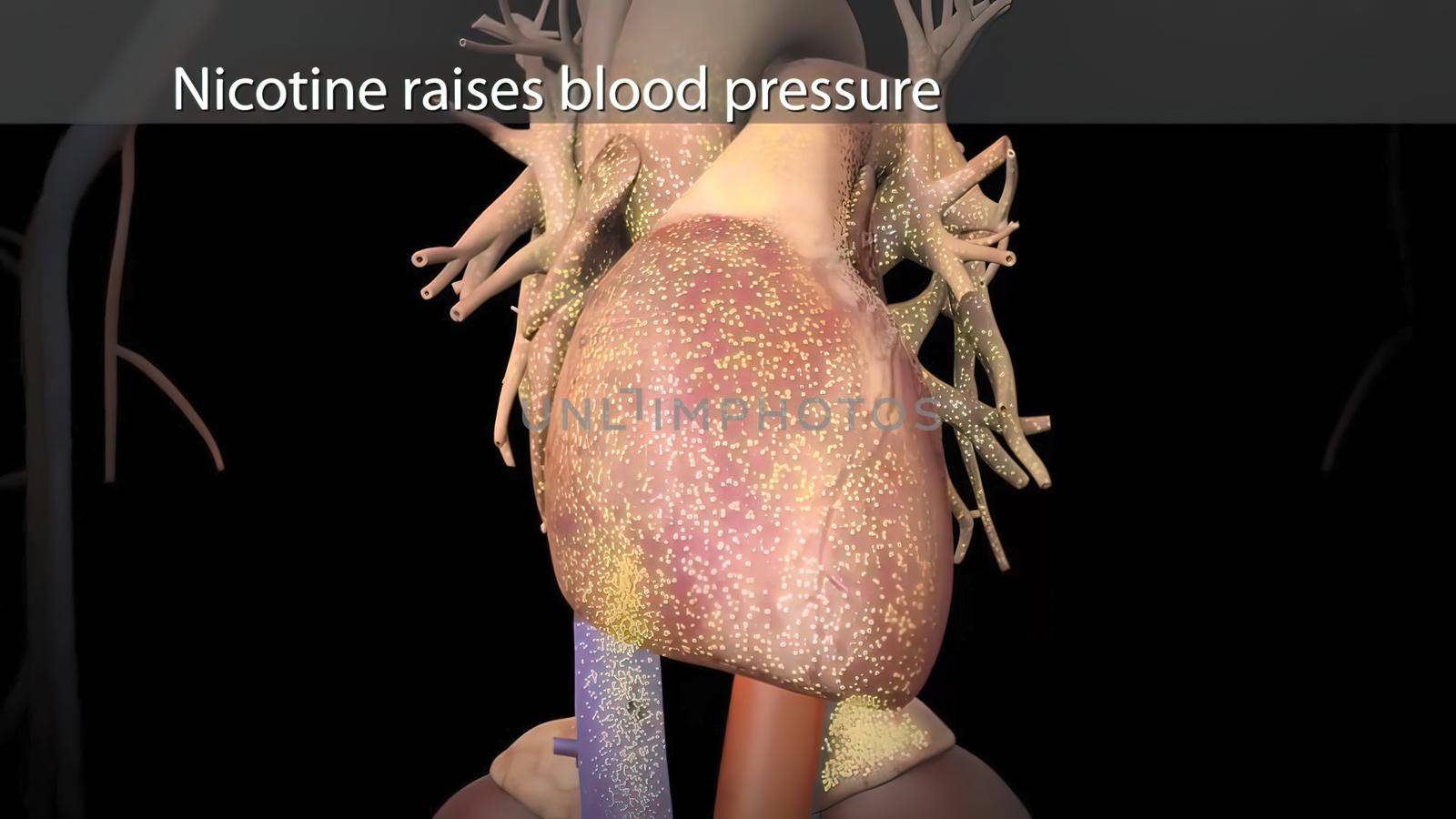Nicotine raises blood pressure 3d illustration
