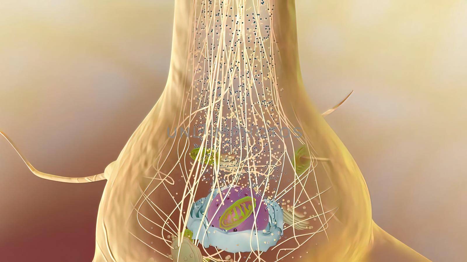 Neurofibrillary tangles are abnormal accumulations of a protein called tau that collect inside neurons 3d medical illustration.
