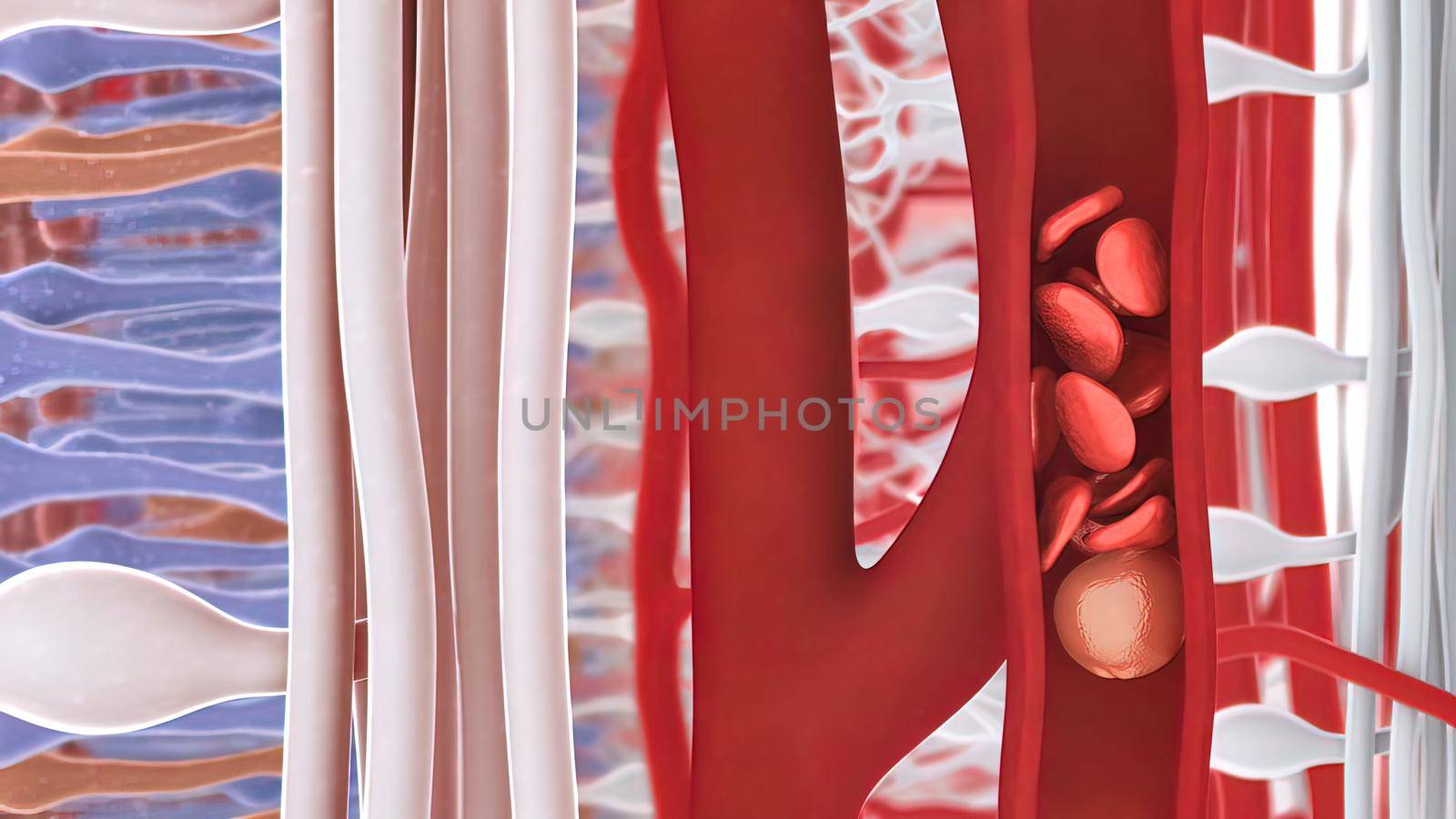 New Vascular Growth in the Retina 3d illustration