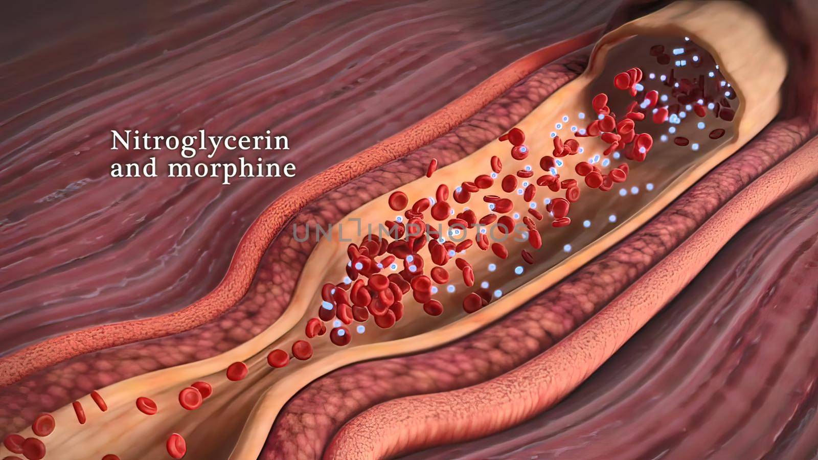 Nicotine raises blood pressure 3d illustration