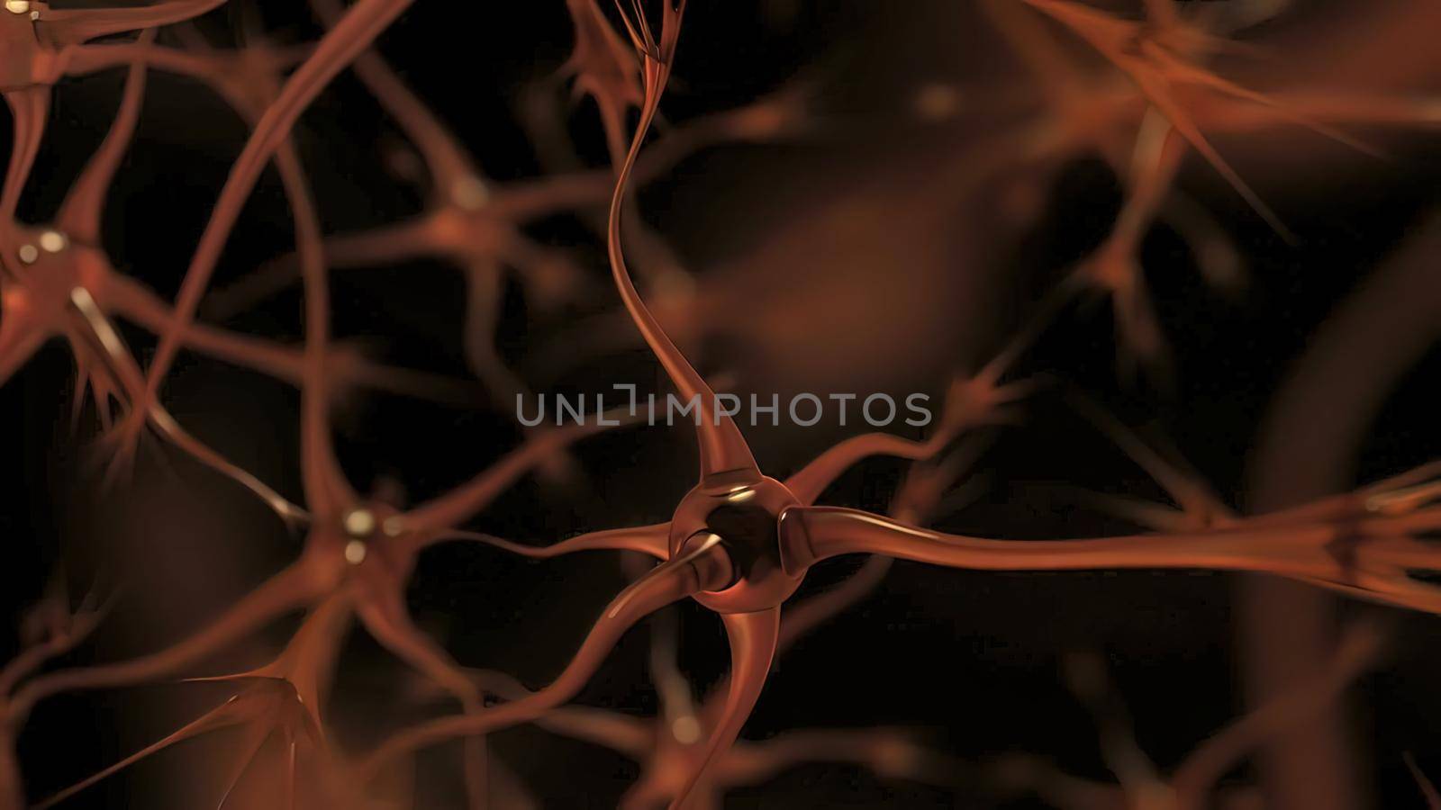 Neurons With Amyloid Plaques, by creativepic