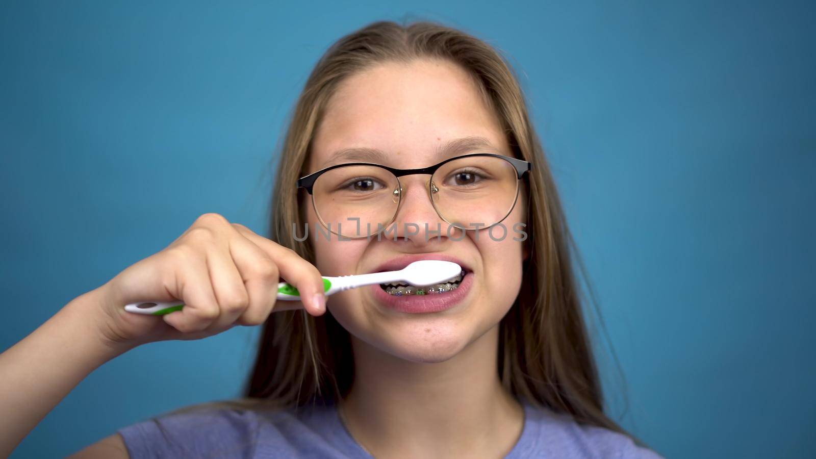 Girl with braces brush her teeth with a toothbrush closeup. A girl with colored braces on her teeth keeps her teeth clean. 4k