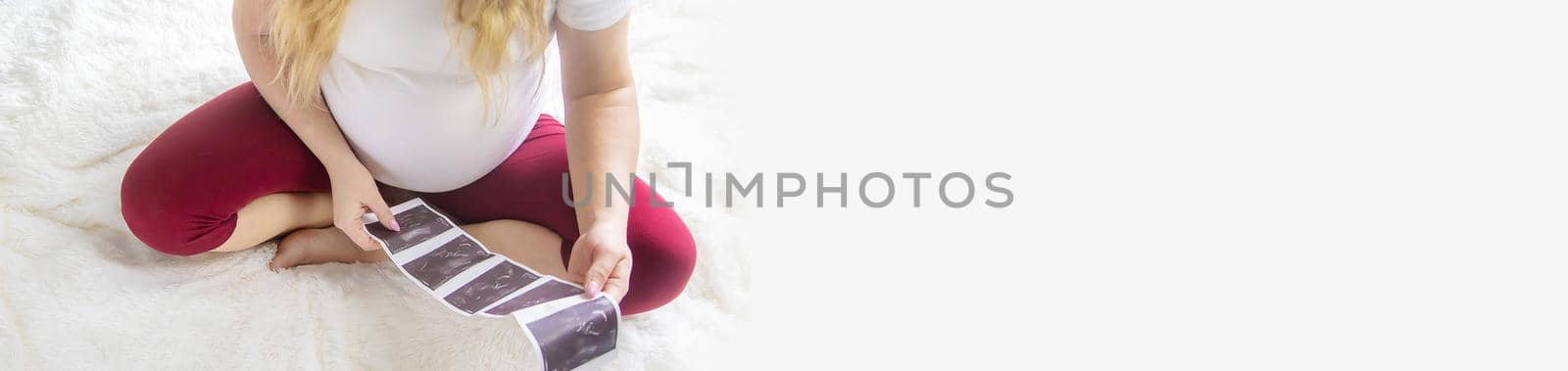A pregnant woman holds a snapshot of an ultrasound in her hands. Selective Focus. people.