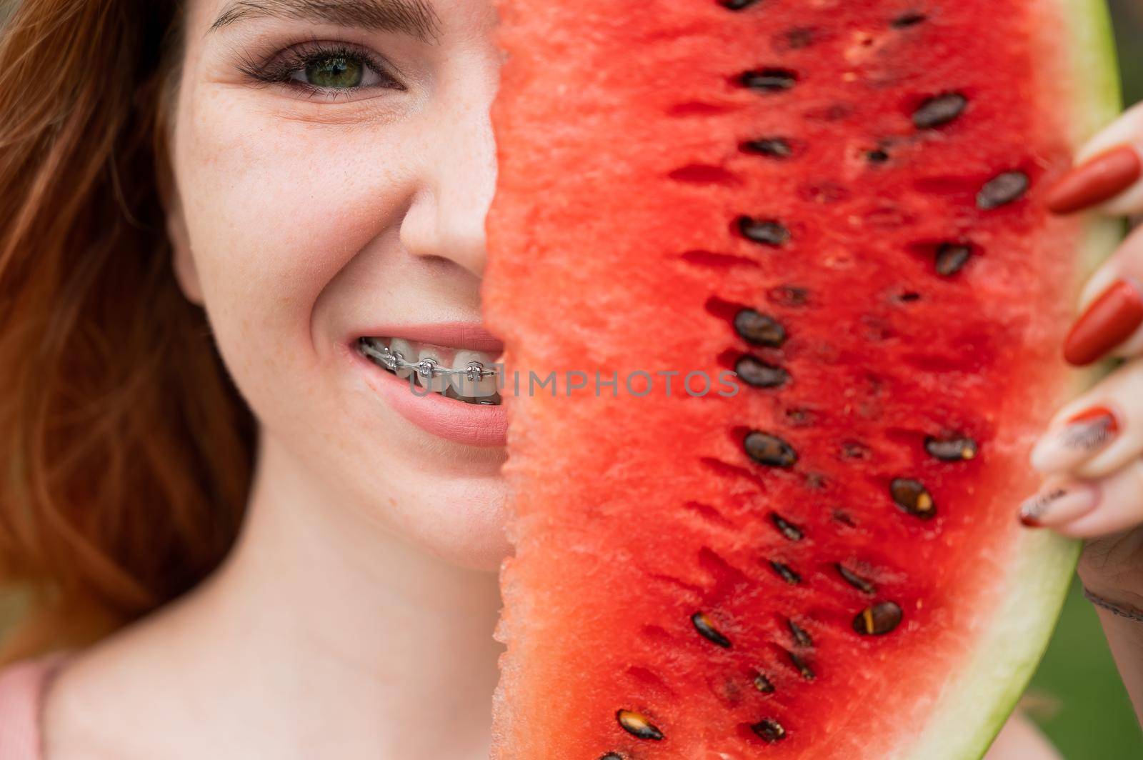 Beautiful red-haired woman smiling with braces on her teeth covers half of her face with a slice of watermelon outdoors in summer.