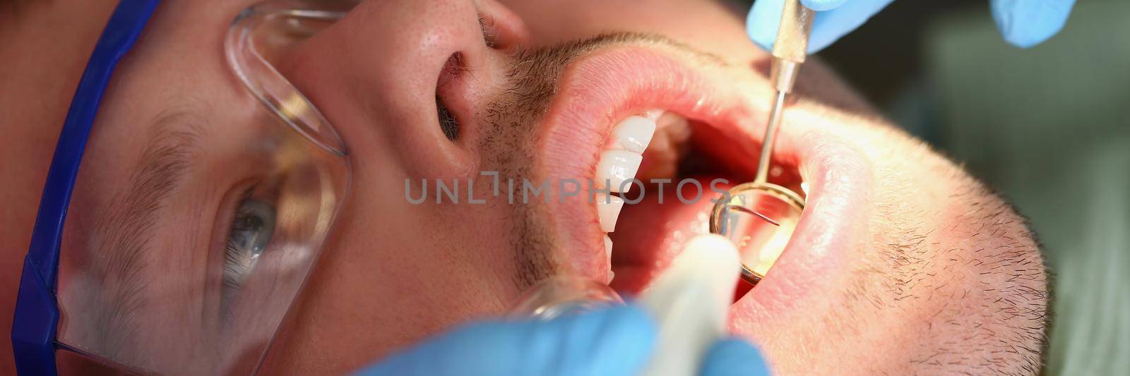 A man treats teeth, a patient's face close-up. Dentist tools, dental clinic, teeth whitening, treatment procedures
