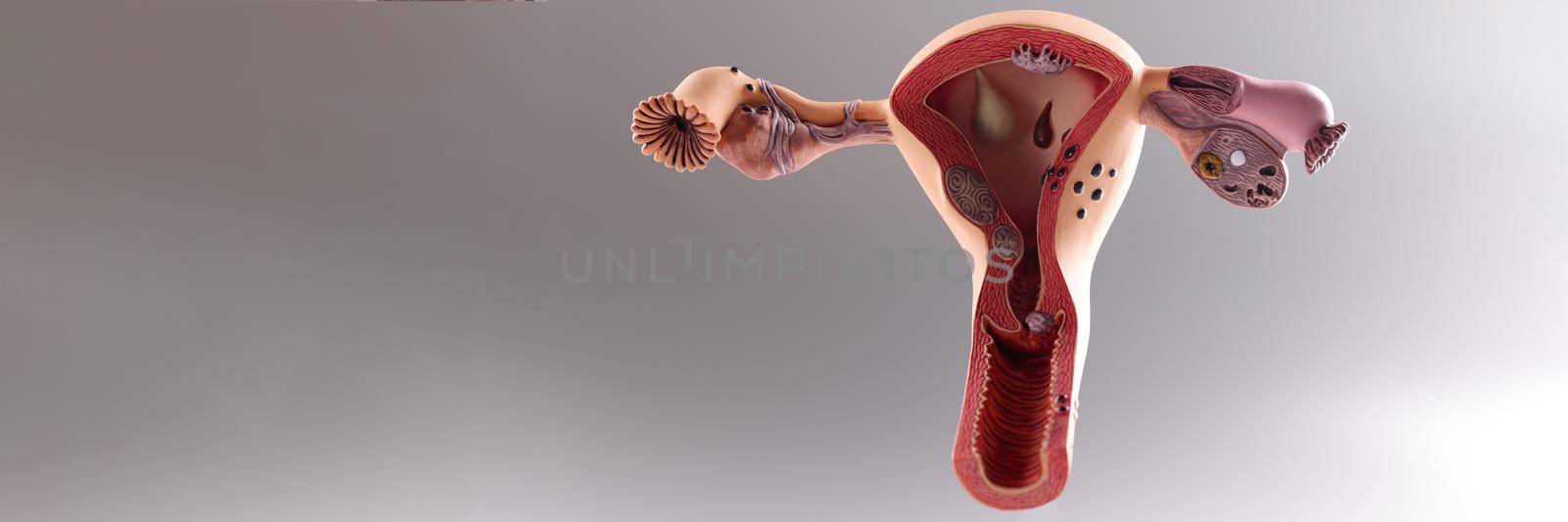 Model of the female reproductive system on gray background by kuprevich