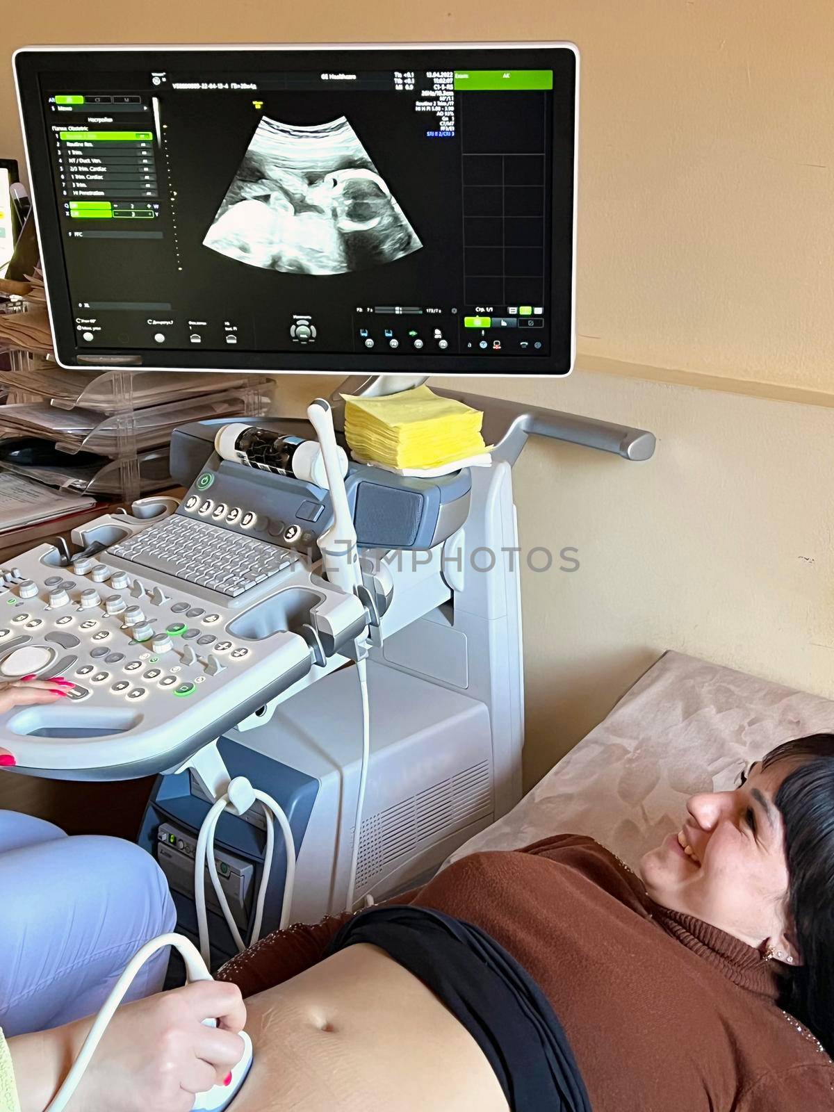 pregnant girl on ultrasound. Obstetrician Pushes Buttons on a Control Panel Before Starting Ultrasound Sonogram Procedure. Skillful sonographer using ultrasound machine at work. pregnancy examination