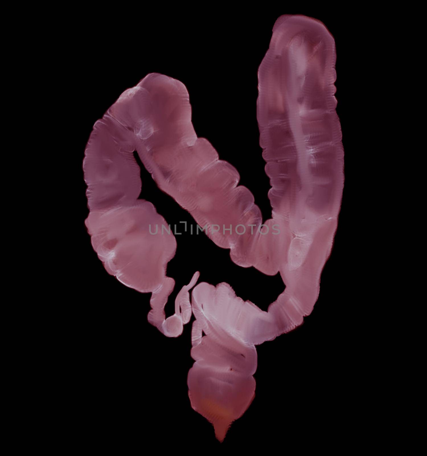 Large bowel or colon in water color technique showing colon for screening colorectal cancer. Check up Screening Colon Cancer.