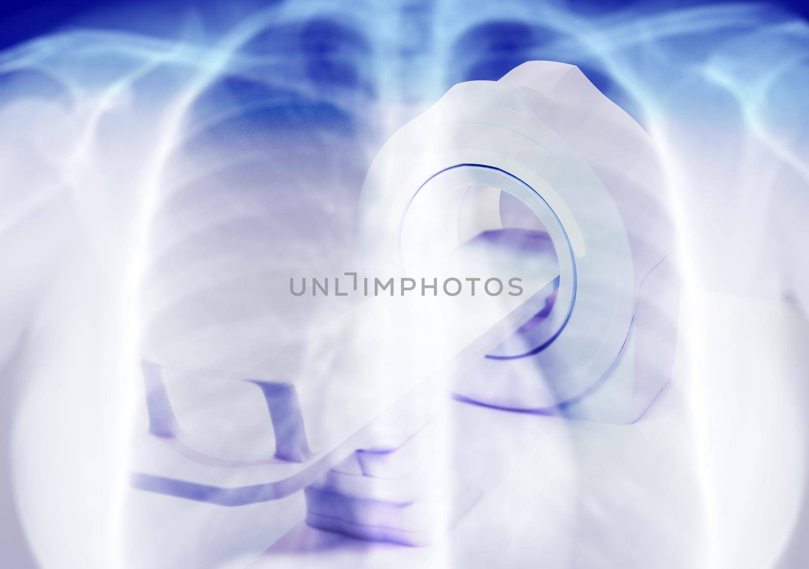 Fusion image of multi detector CT Scanner ( Computed Tomography ) on chest x-ray background for diagnosis covid - 19.