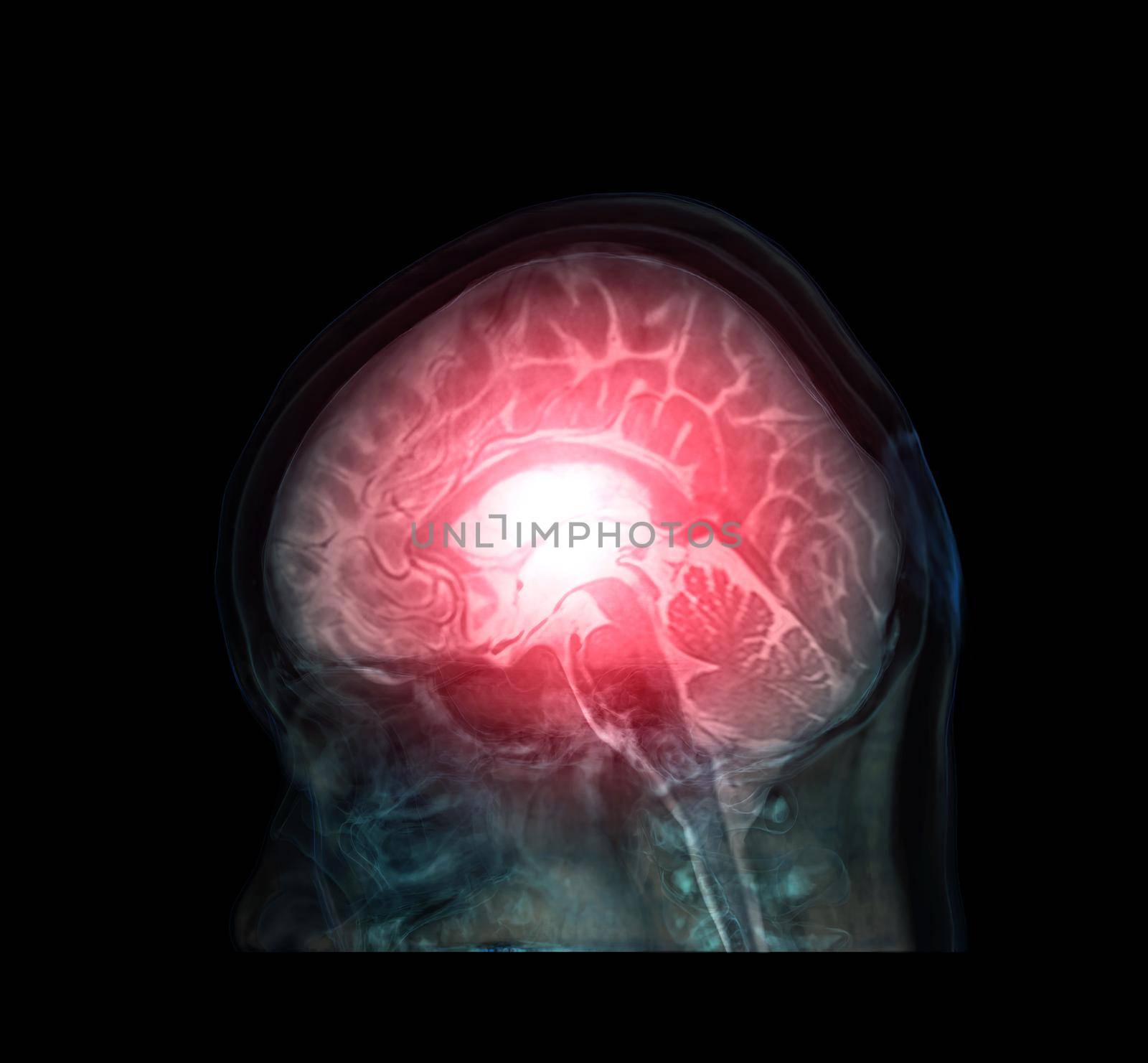 transparent image of the Skull Lateral with Brain for medical background concept.