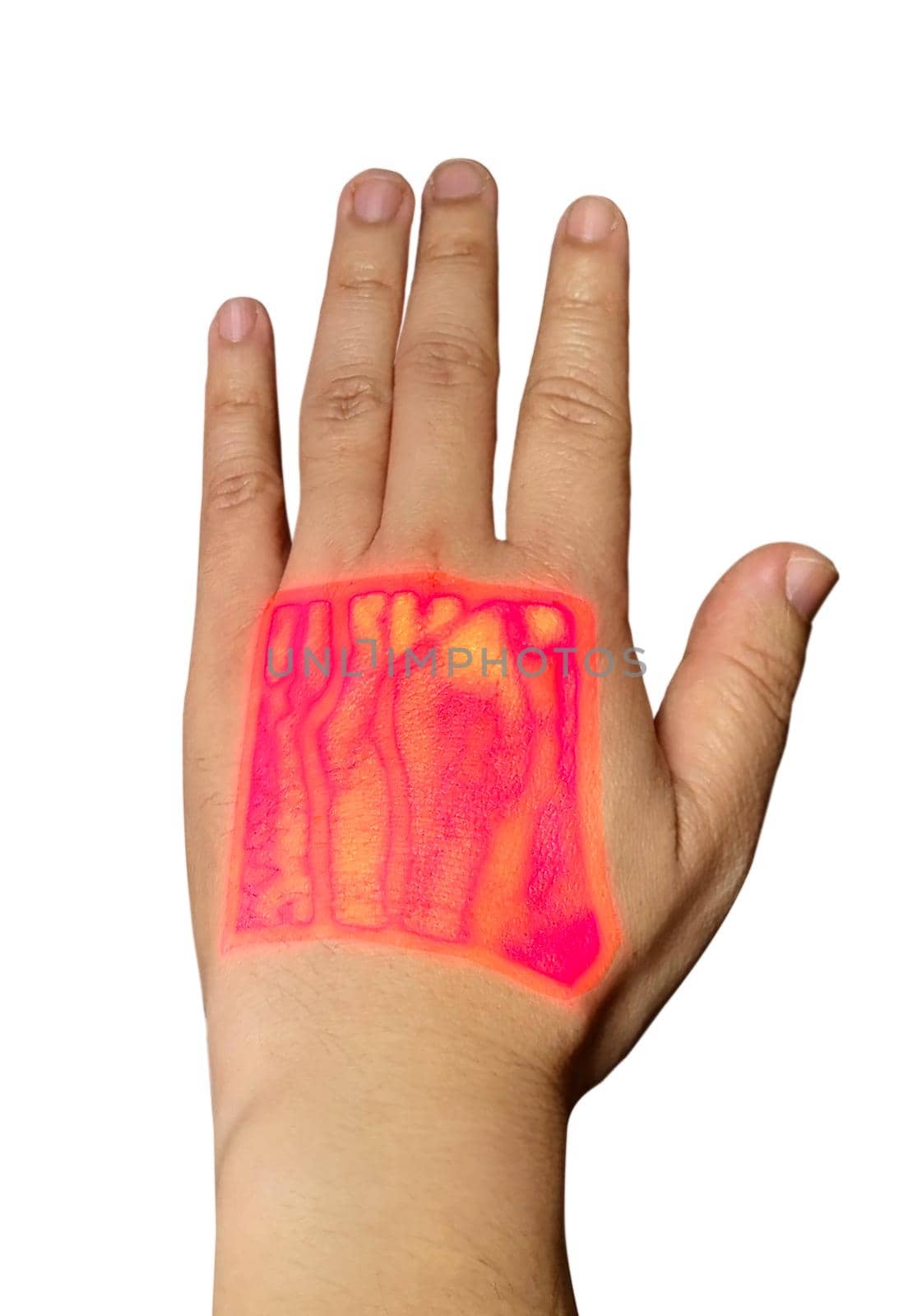 Vein finder handheld infrared of left hand showing cephalic vein and basilic vein for blood sample test. Clipping path.
