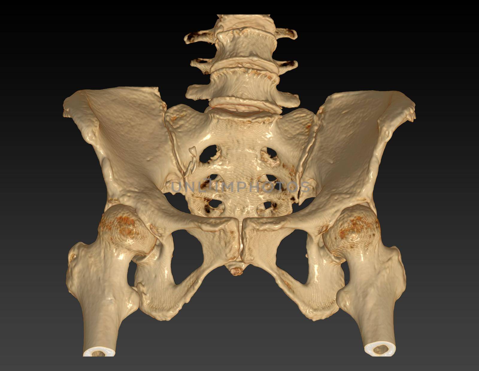 CT Scan of pelvic bone with both hip joint 3D rendering image Outlet view isolated on black background. Clipping path.