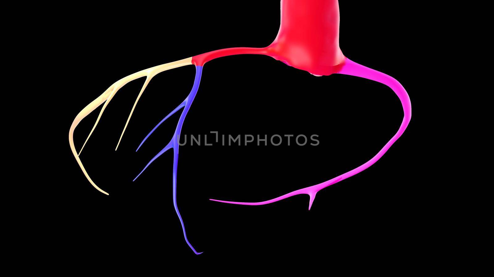 CTA Coronary artery 3D rendering image or coronary tree 3d illustrations on black background. Clipping path