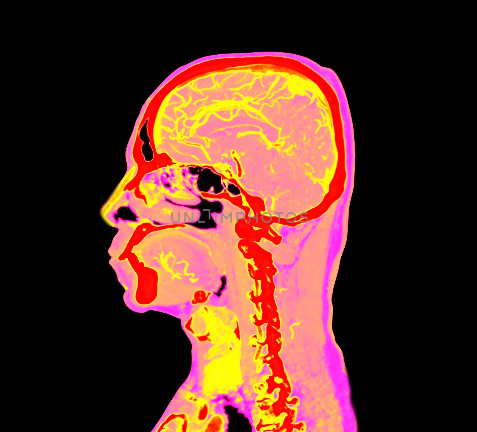 colorful of CT angiography of the brain or CTA brain Sagittal view . Clipping path.