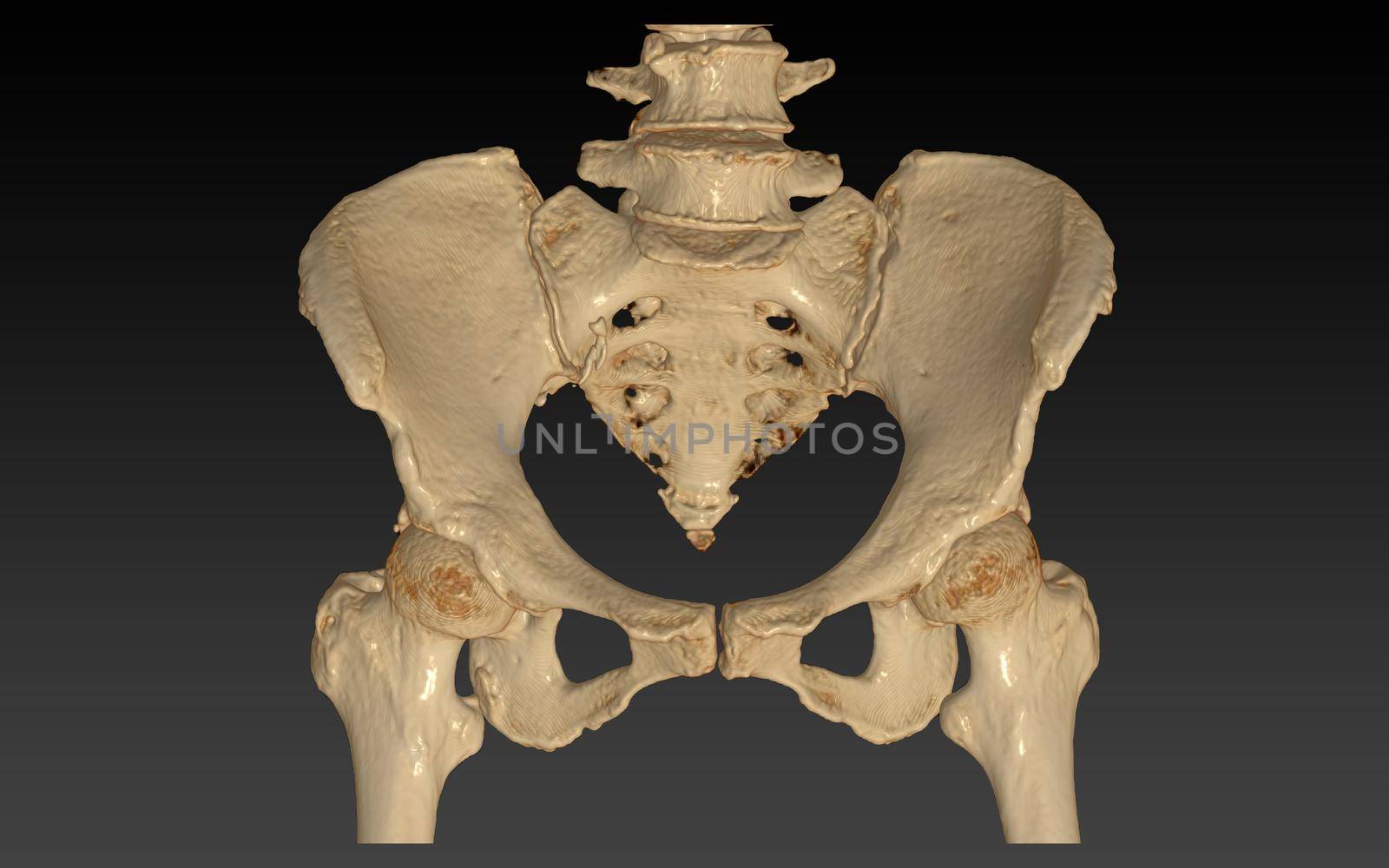 CT Scan of pelvic bone with both hip joint 3D rendering image isolated on black background. Clipping path. by samunella