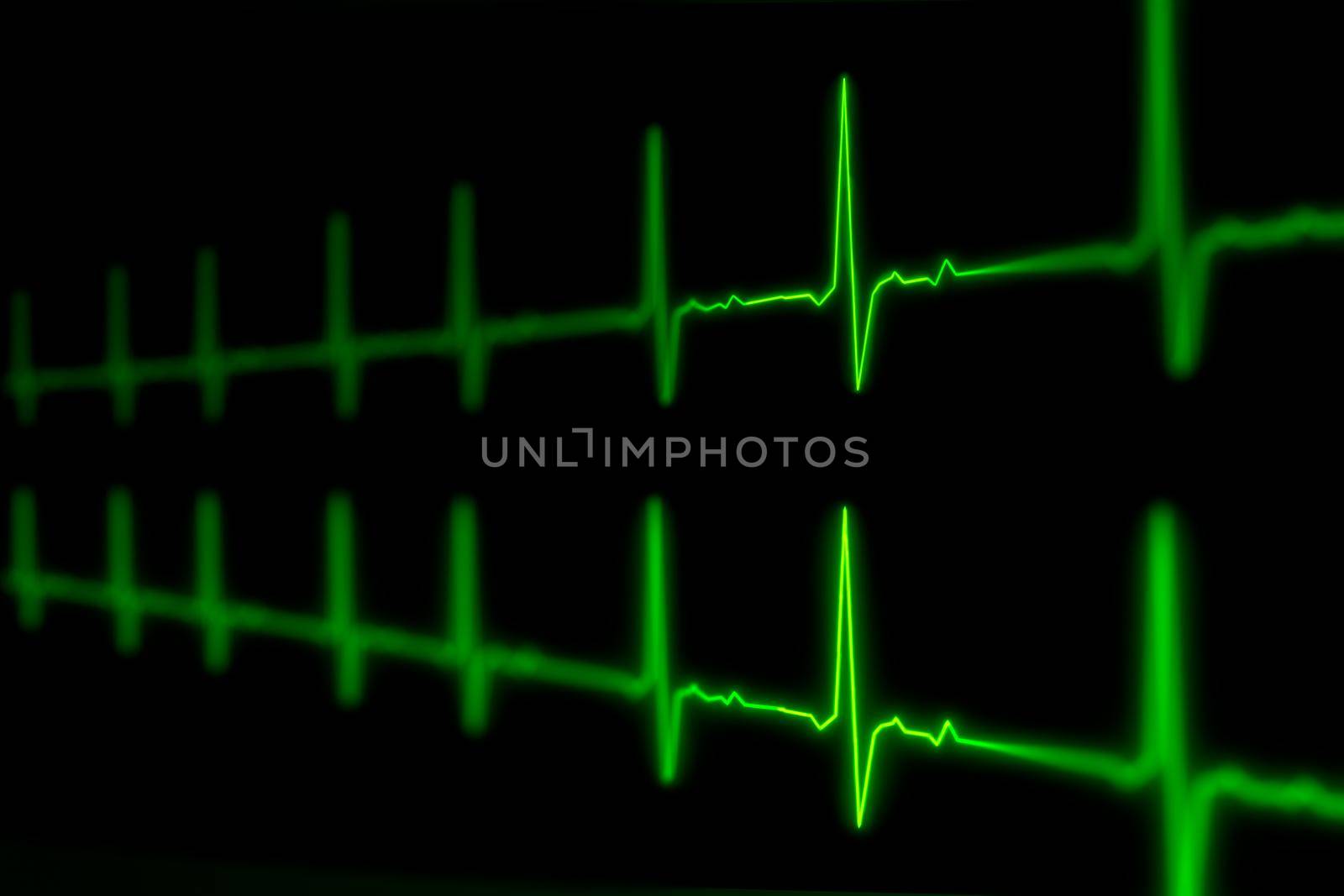 ECG or EKG pulse heartbeat of life sign green line 3D illustration.