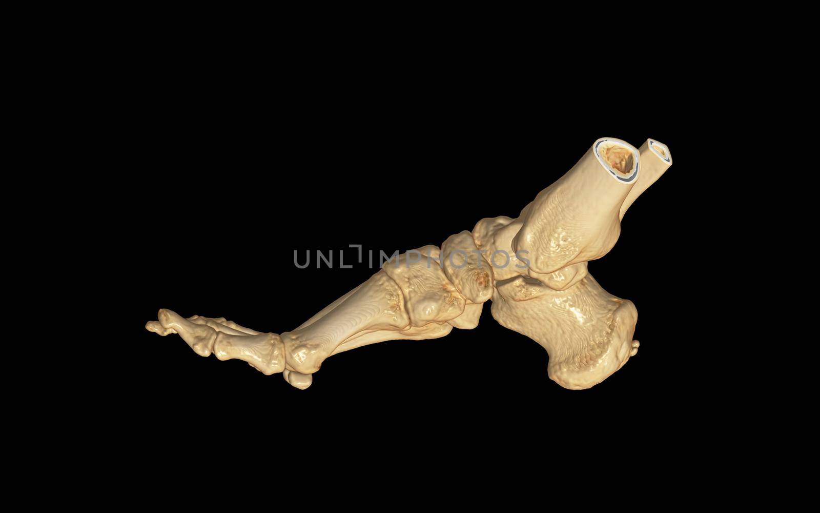 CT Scan of Right Foot 3D rendering image Lateral View .medical technology concept.