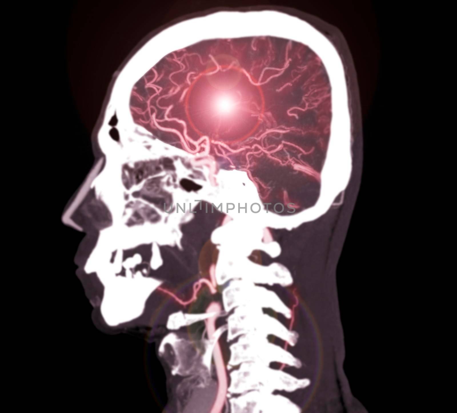 colorful of CT angiography of the brain or CTA brain sagittal view .