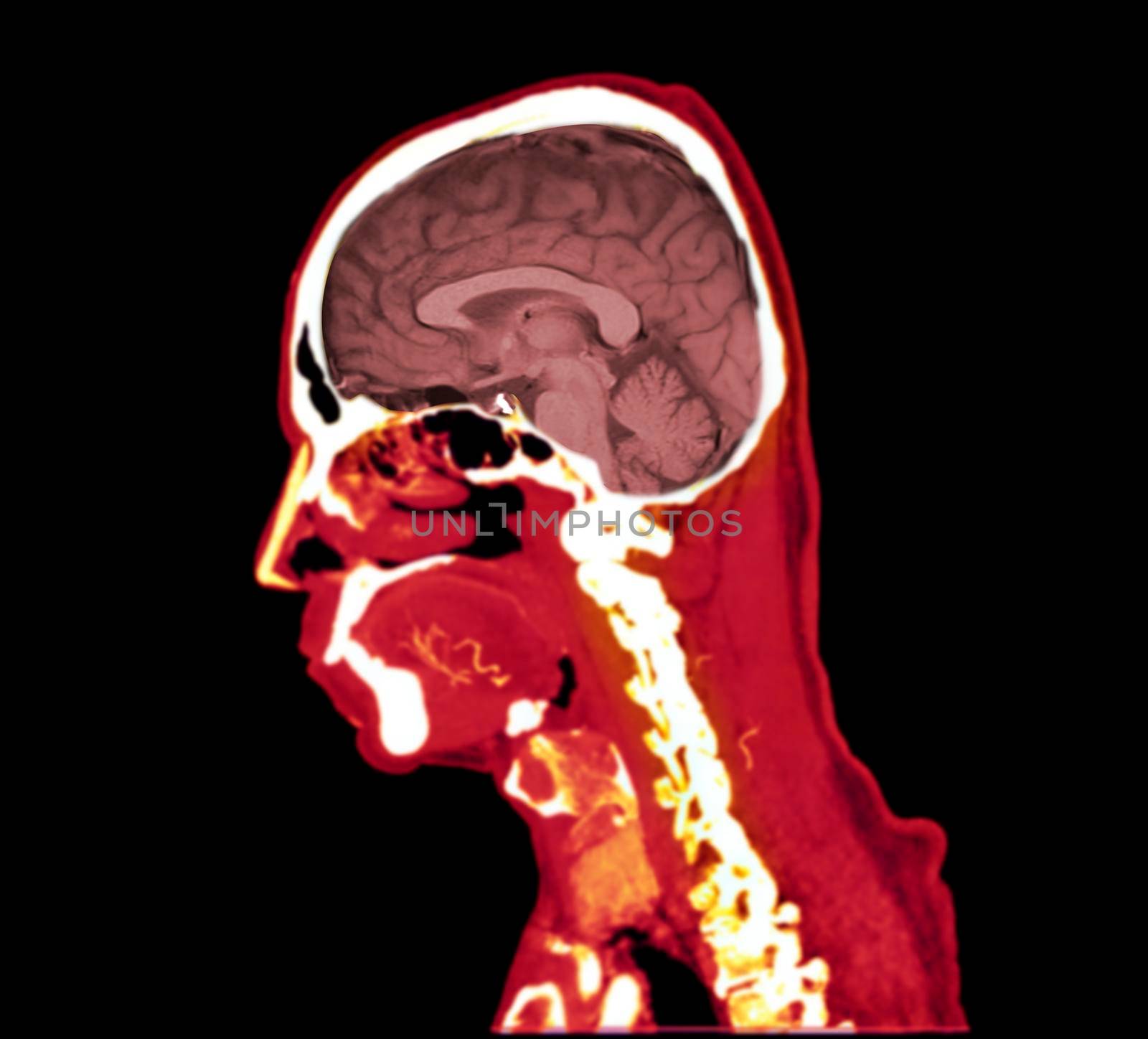 colorful of CT angiography of the brain or CTA brain Sagittal view . Clipping path.