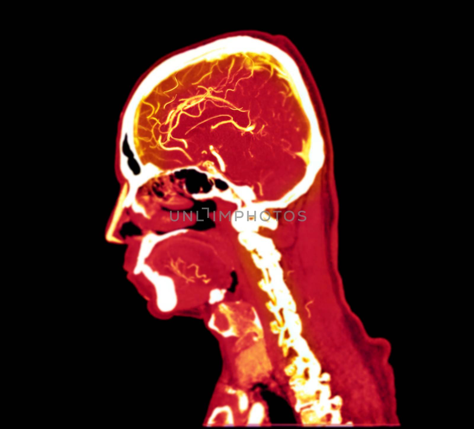 colorful of CT angiography of the brain or CTA brain Sagittal view . Clipping path.