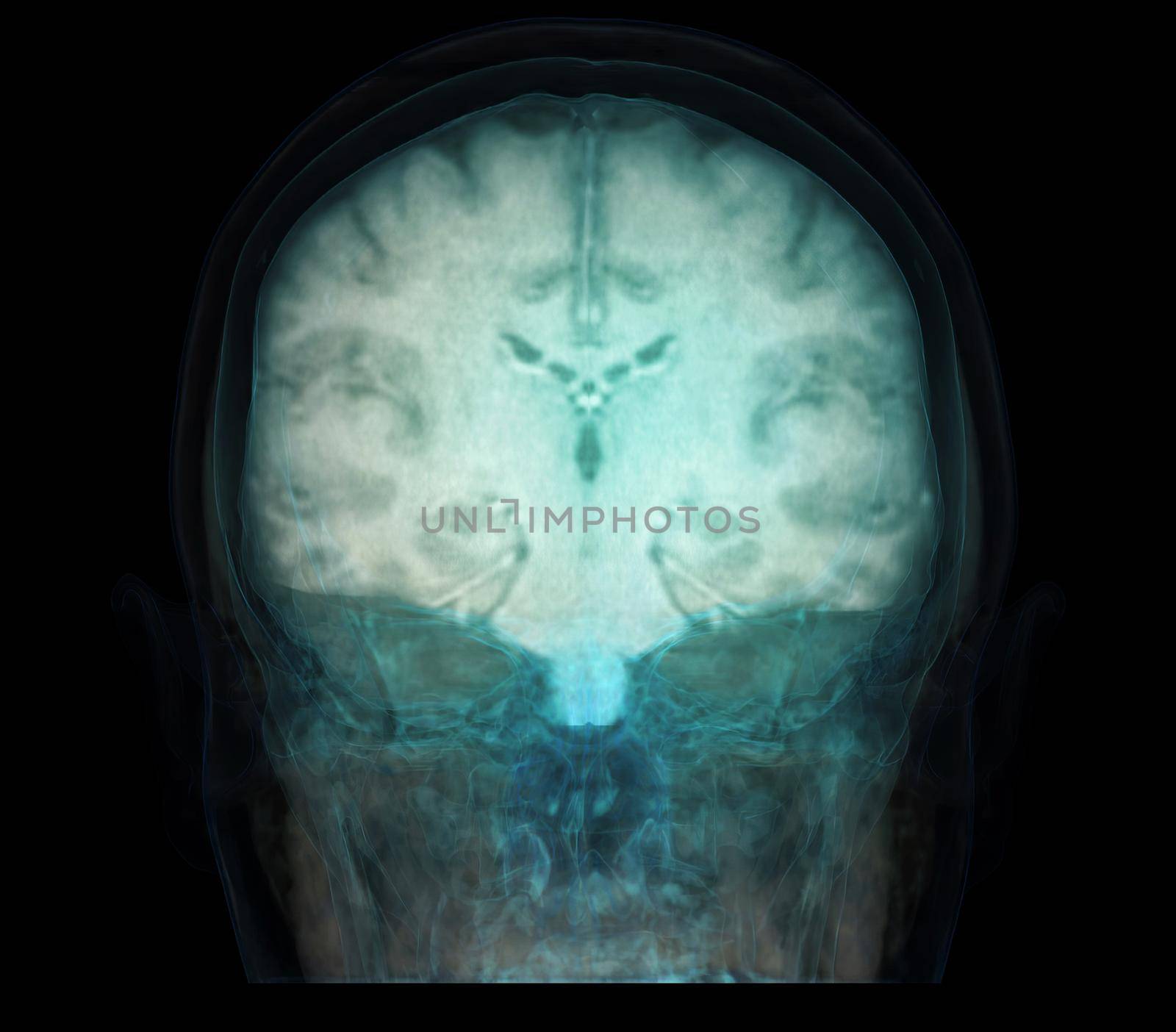 transparent image of the Skull AP Blue color with Brain for medical background concept.