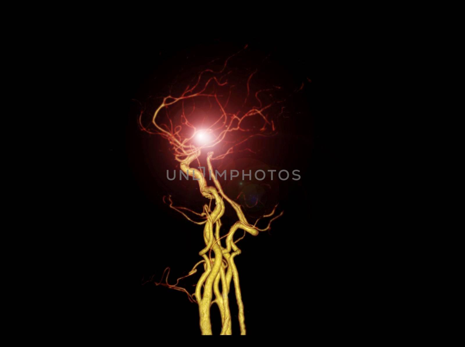 CTA BRAIN or CT angiography of the brain 3D Rendering image showing cerebral artery. by samunella