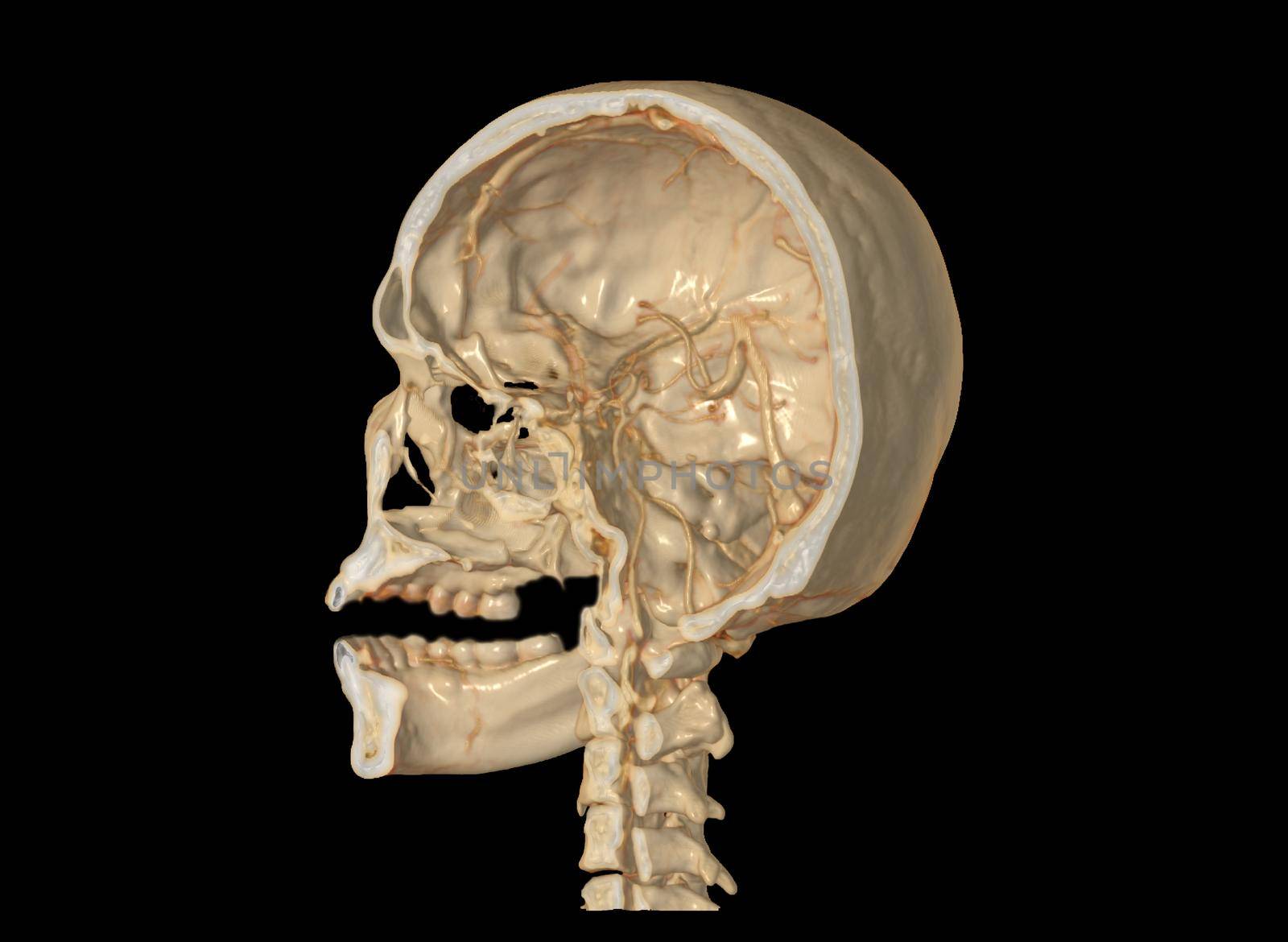 A Haft of the skull 3D showing the brain inside the skull. .