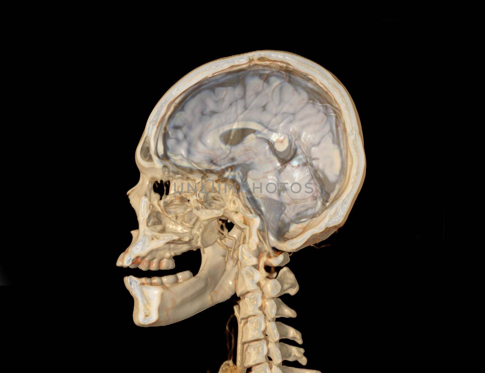 A Haft of the skull 3D showing the brain .