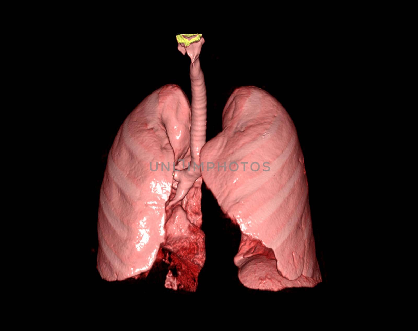 3d renderings of human lung showing respiratory system. by samunella