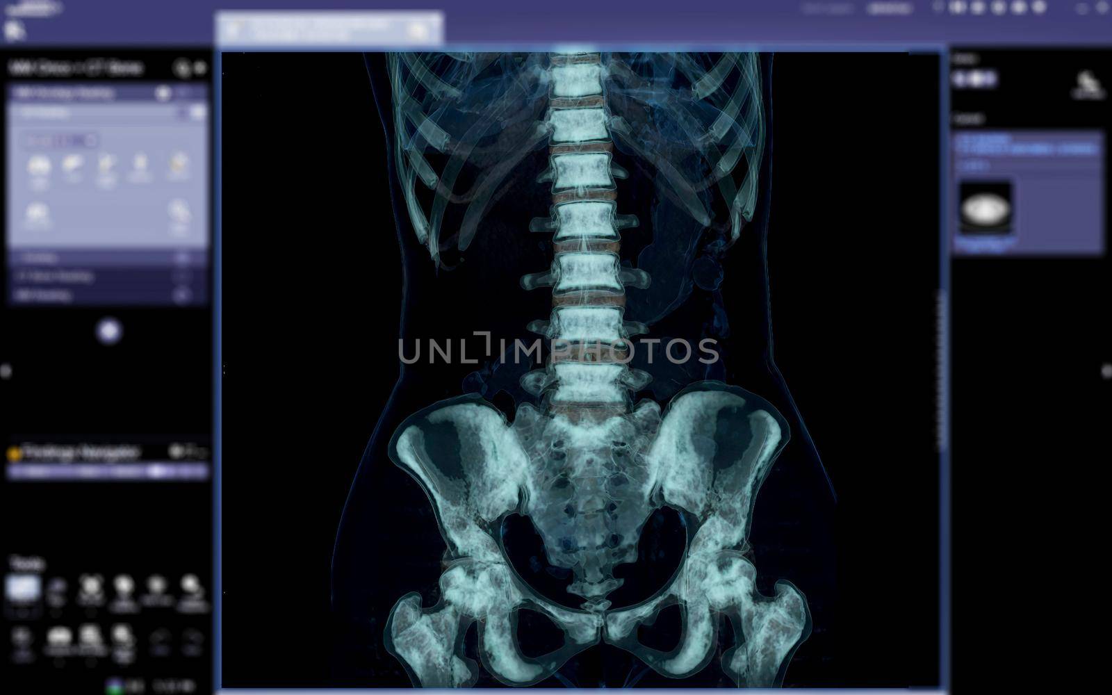 lambar spine 3D render isolated on medical the screen. by samunella